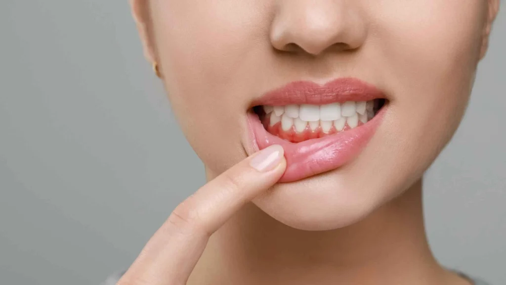 How Your Gums Are Trying To Tell You | Early Signs Of Gum Disease