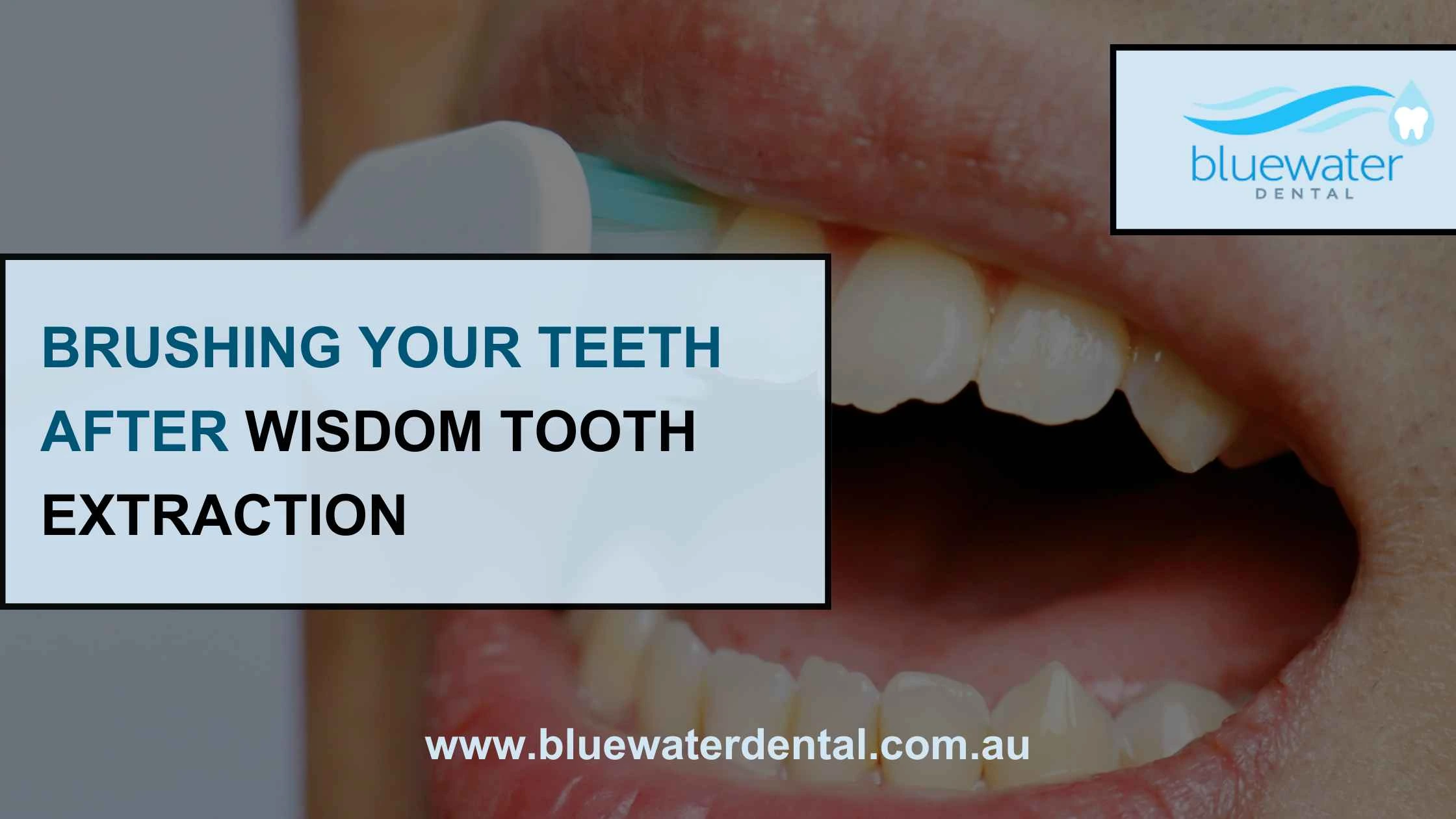 Brushing Your Teeth After Wisdom Tooth Extraction