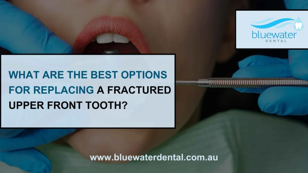 Dentist explaining the best treatment options for replacing a fractured upper front tooth, including dental implants, crowns, and bridges.